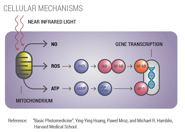 Photobiomodulation Parkinson's Study 